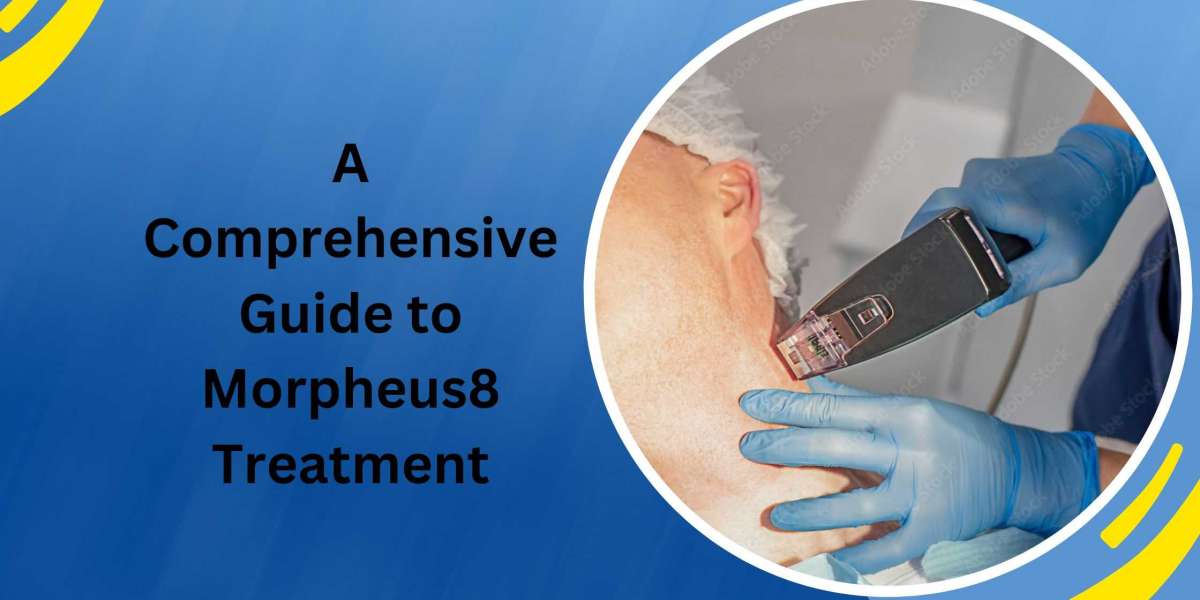 A Comprehensive Guide to Morpheus8 Treatment