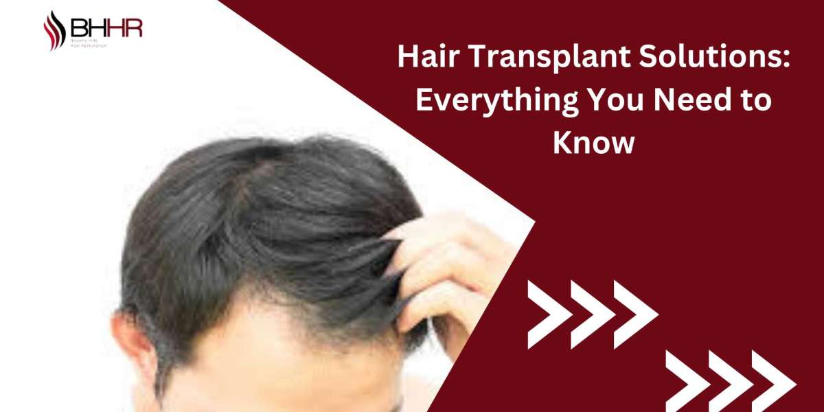 Hair Transplant Solutions: Everything You Need to Know